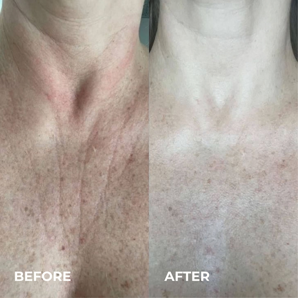 Veylora Silk Peptide EGF Toner