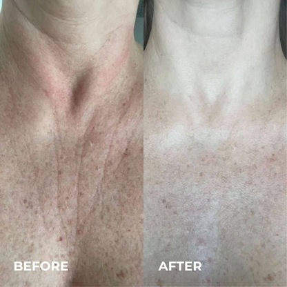 Veylora Silk Peptide EGF Toner